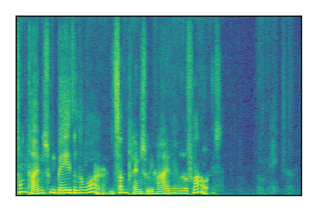An audio spectrogram.
