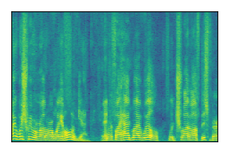 An audio spectrogram.