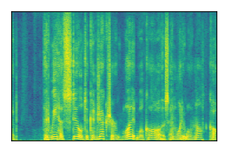 An audio spectrogram.