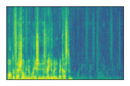 An audio spectrogram.