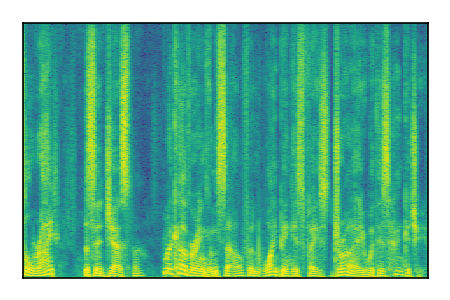 An audio spectrogram.