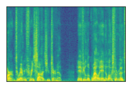 An audio spectrogram.