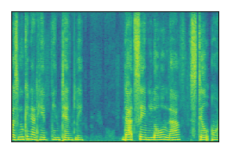 An audio spectrogram.
