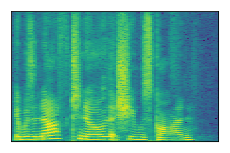 An audio spectrogram.