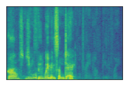 An audio spectrogram.