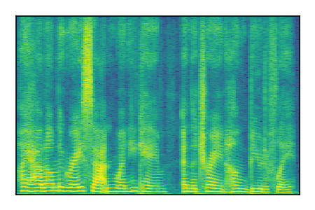 An audio spectrogram.