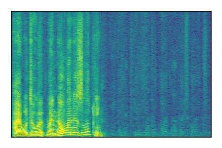 An audio spectrogram.