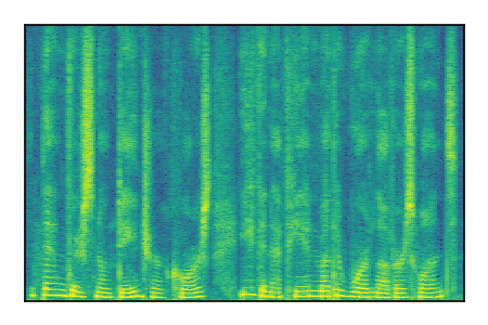 An audio spectrogram.