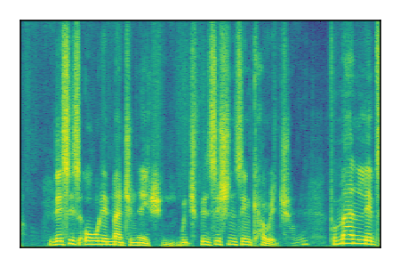 An audio spectrogram.