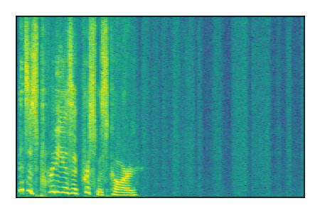 An audio spectrogram.
