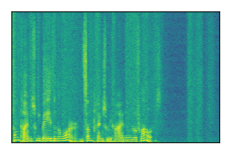 An audio spectrogram.