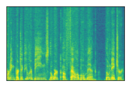 An audio spectrogram.
