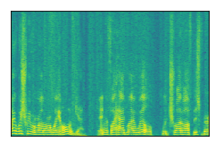 An audio spectrogram.