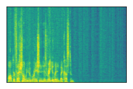 An audio spectrogram.