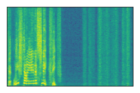 An audio spectrogram.