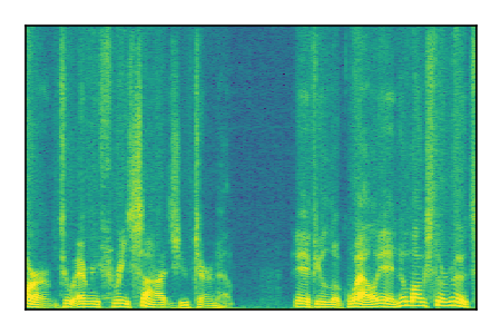 An audio spectrogram.