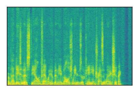 An audio spectrogram.