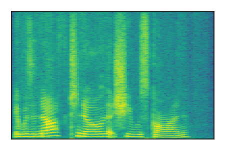 An audio spectrogram.