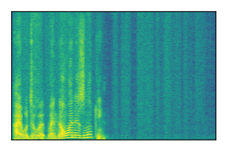 An audio spectrogram.