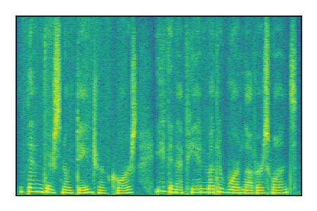 An audio spectrogram.