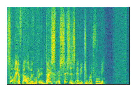 An audio spectrogram.