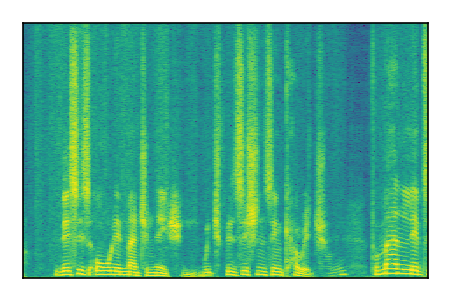 An audio spectrogram.