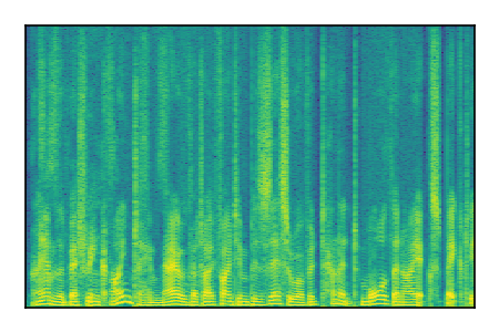An audio spectrogram.