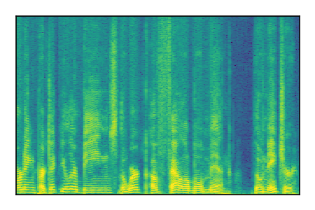 An audio spectrogram.