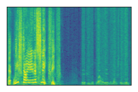 An audio spectrogram.