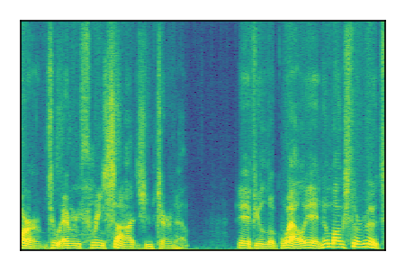 An audio spectrogram.