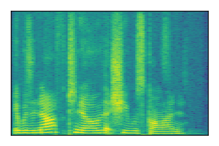 An audio spectrogram.