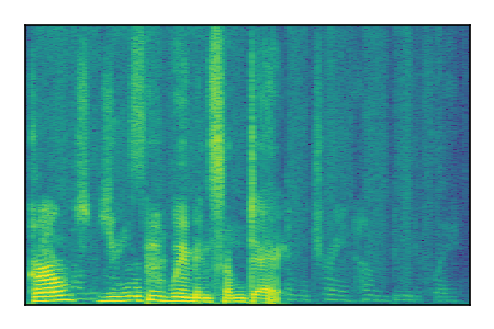 An audio spectrogram.
