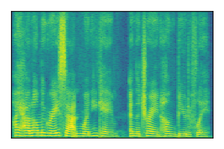 An audio spectrogram.
