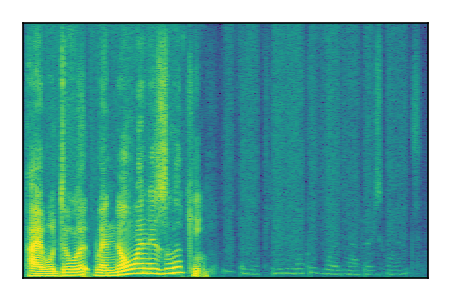An audio spectrogram.
