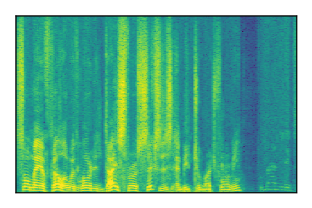 An audio spectrogram.