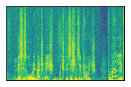 An audio spectrogram.