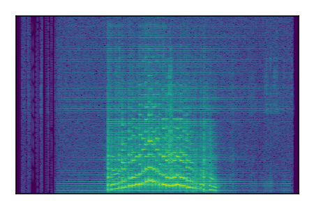 An audio spectrogram.