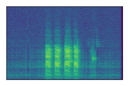 An audio spectrogram.