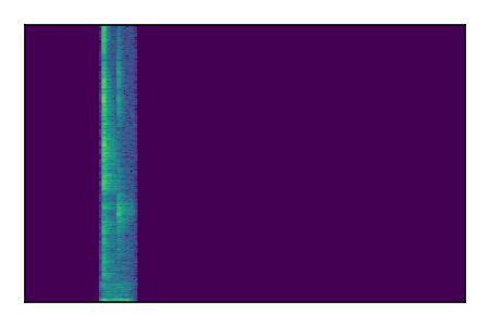 An audio spectrogram.