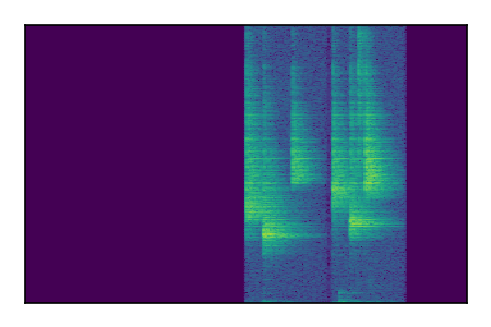 An audio spectrogram.