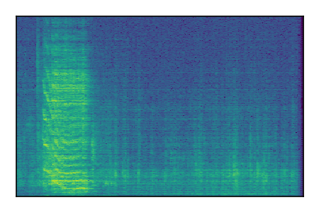 An audio spectrogram.