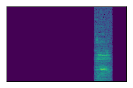 An audio spectrogram.