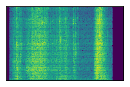 An audio spectrogram.