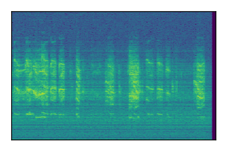 An audio spectrogram.