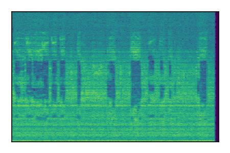 An audio spectrogram.