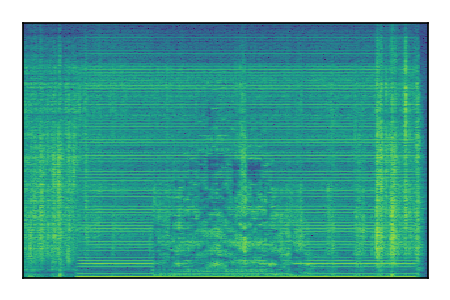 An audio spectrogram.