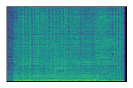 An audio spectrogram.