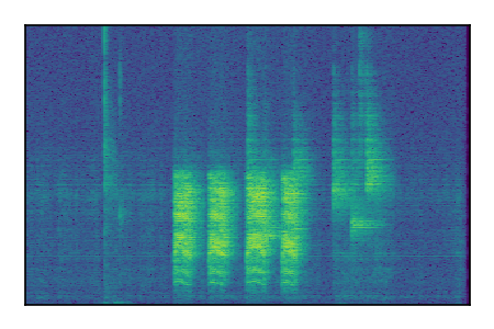 An audio spectrogram.