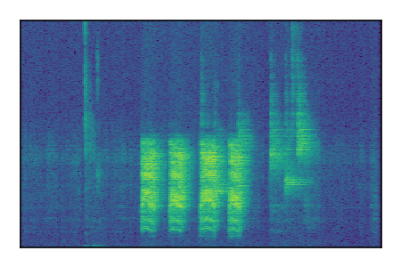 An audio spectrogram.