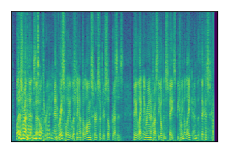 An audio spectrogram.